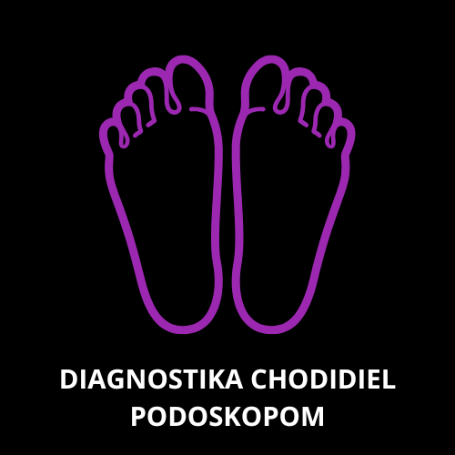 Diagnostika chodidiel podoskopom – detailná analýza stability, zaťaženia a funkcie chodidiel.